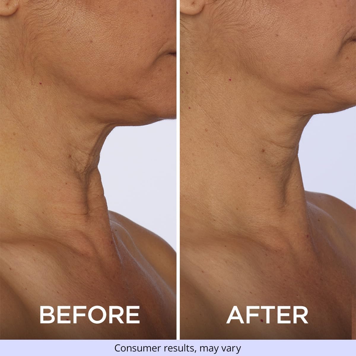 goPure Neck Firming Cream - 1.7 oz | Anti-Aging, for Tightening and Wrinkles, for an Even Skin Tone and Neck Lift, With Pro-Active Firming Complex ? ? ? ? ? - Image 4