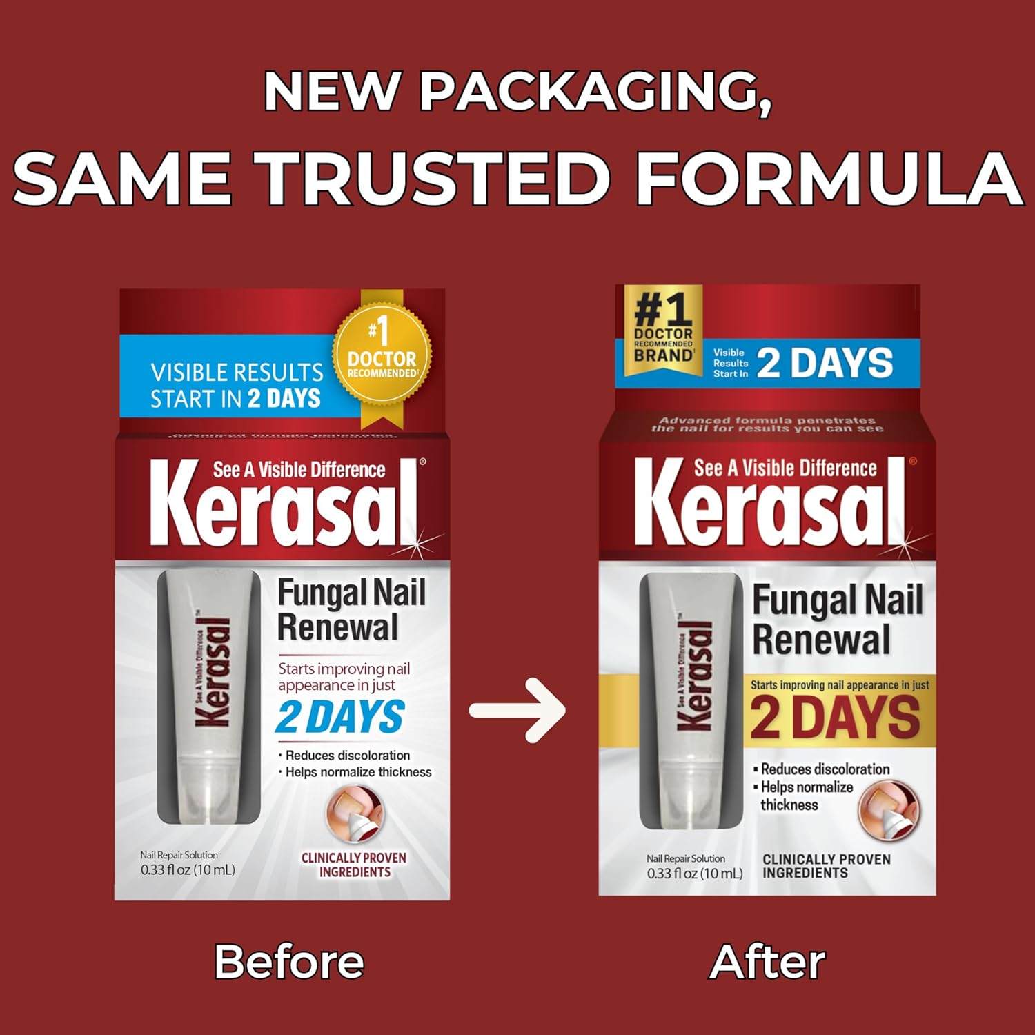 Kerasal Nail Renewal, Restores Appearance of Discolored or Damaged Nails, 0.33 fl oz (Packaging May Vary) ? ? ? ? ? - Image 5