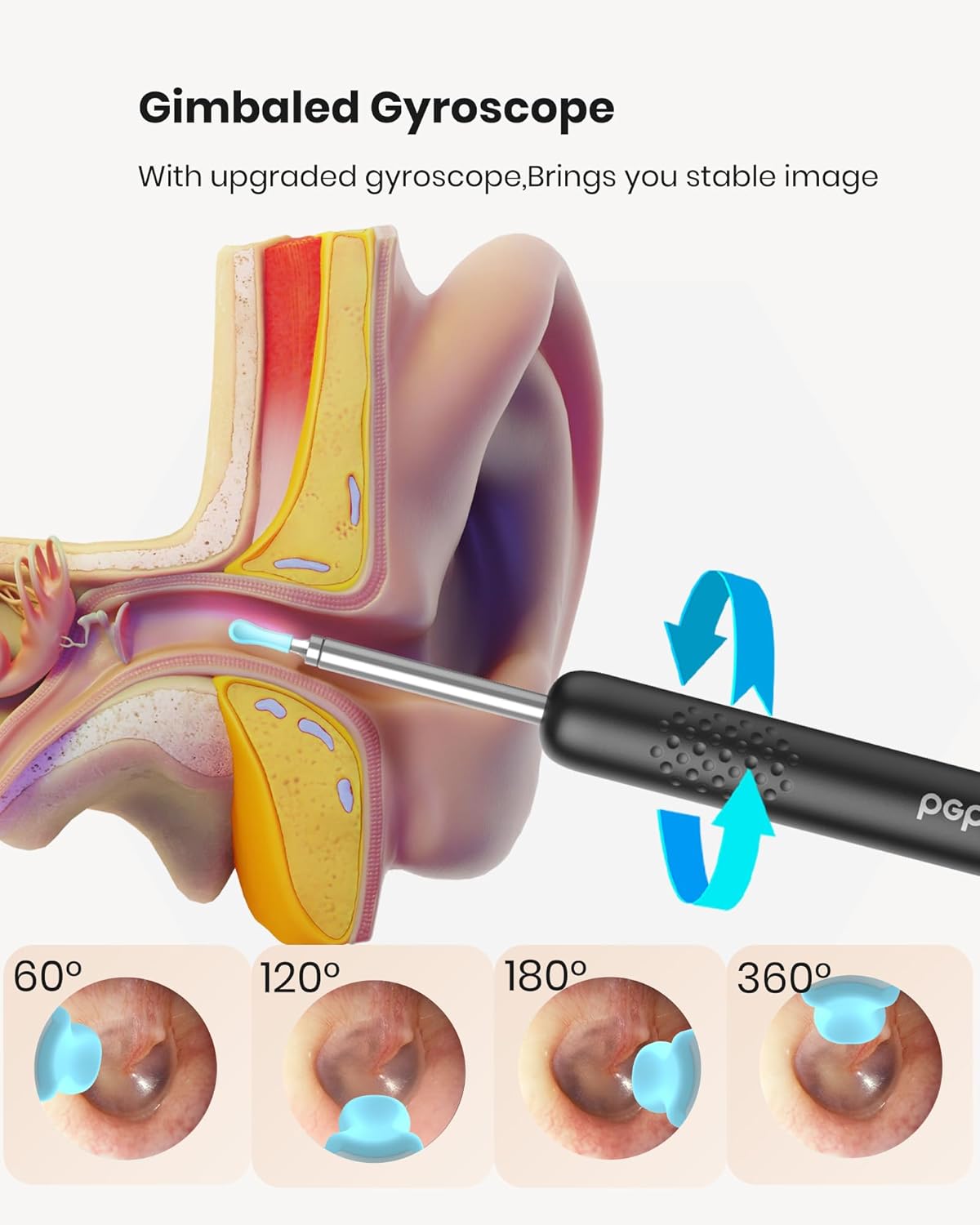 BEBIRD R1 Wax Removal Tool for Ear - Spade Ear Canal Cleaner with Camera 1080P Earscope, Wax Remove Ear Picker with Vari Replacement Tips, Camera with 6LED Light for Ear/Nose/Throat Examination, Black - Image 6
