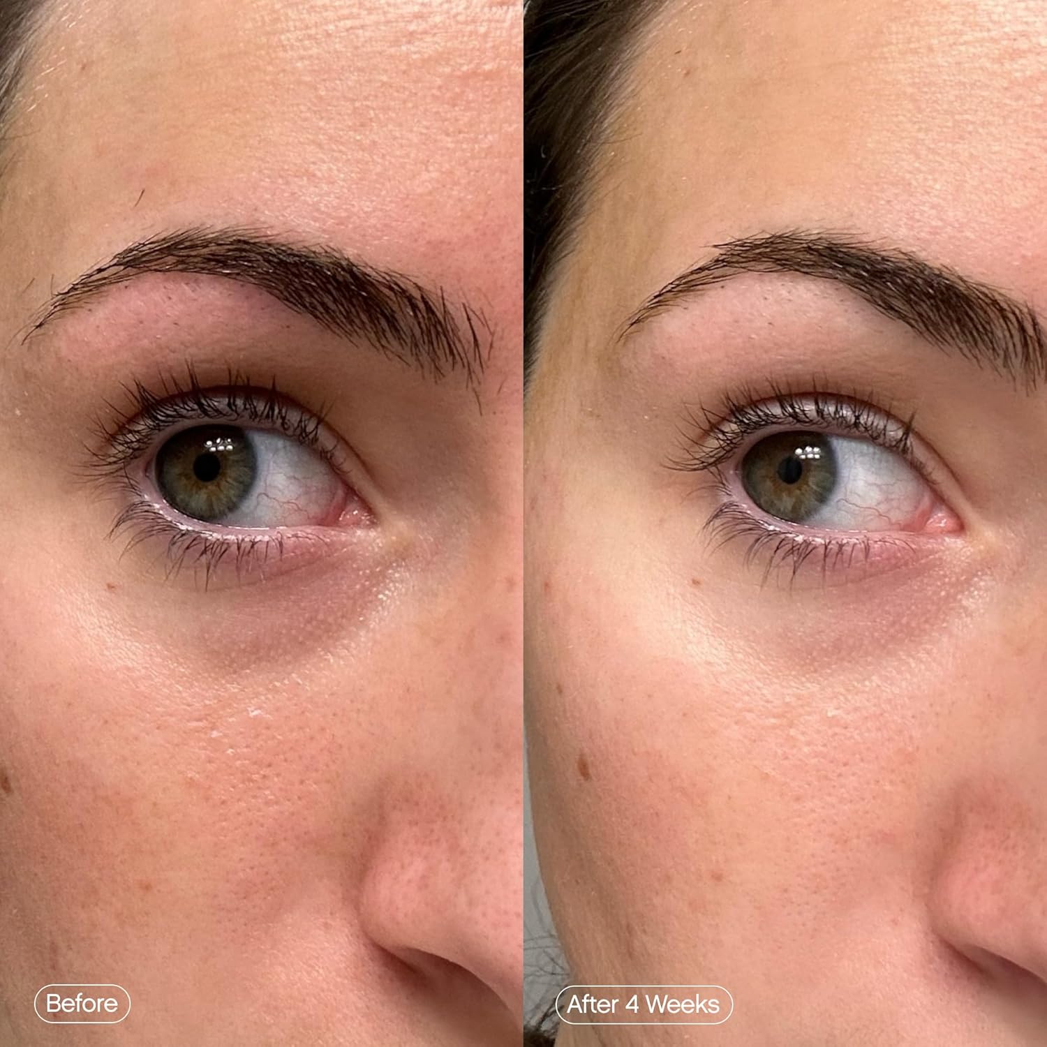 Topicals Faded Brightening Under Eye Masks | Patches to Depuff, Hydrate, Brighten and Cool | Reduce Dark Circles and Fine Lines | Contains Kojic Acid, Caffeine and Niacinamide (Set of 6) ? ? ? ? ? - Image 5